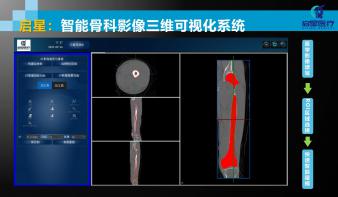 骨科三维可视化系统平台
